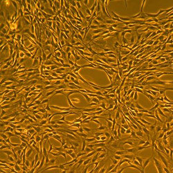 人脂肪间充质干细胞-脂肪 FC-003
