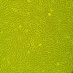 牙龈成纤维细胞 FC-0095 Human G