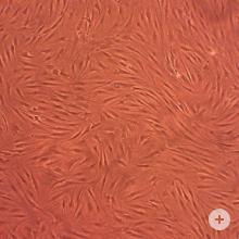 人成纤维细胞样滑膜细胞：骨关节炎