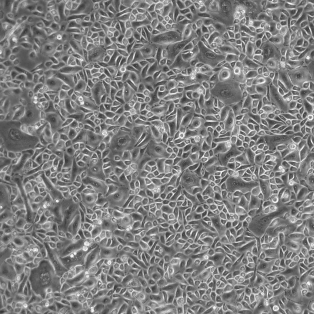 人气管/支气管病变上皮细胞-原代 FC-0103 Diseased Bronchial/Tracheal Epithelial Cells, Primary