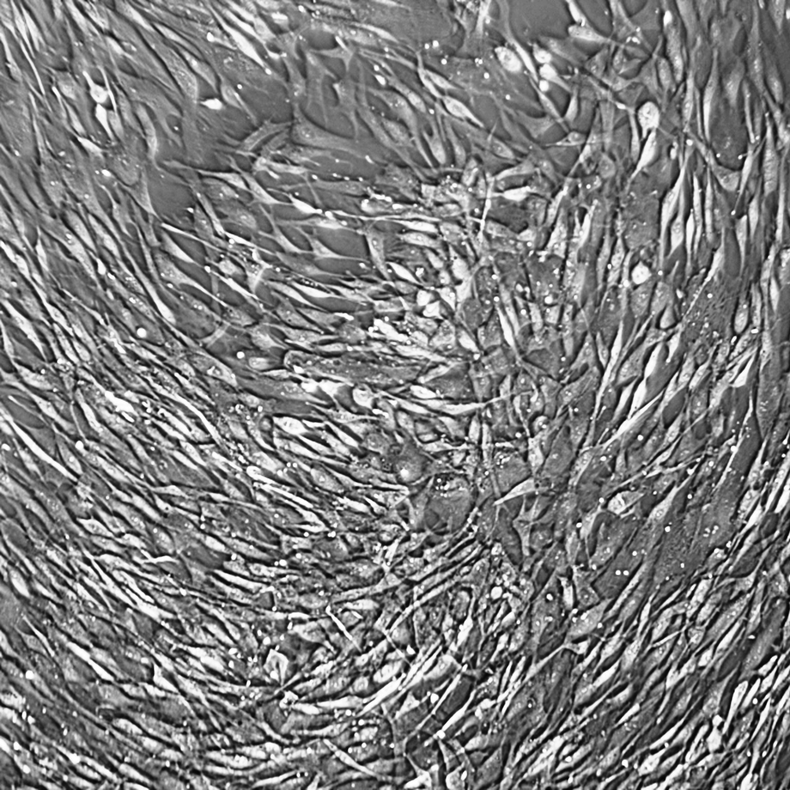 人气管/支气管上皮细胞-原代 FC-0035 Human Bronchial/Tracheal Epithelial Cells, Primary