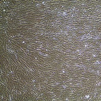 人前列腺平滑肌细胞 FC-0100 Prostate Smooth Muscle Cells