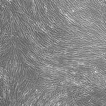 人前列腺成纤维细胞 FC-0099 Prostate Fibroblasts, Human