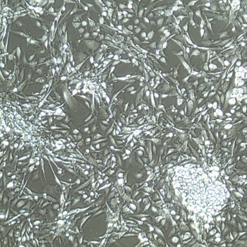 输卵管上皮细胞 FC-0081 Fallopian Tube Epithelial Cell